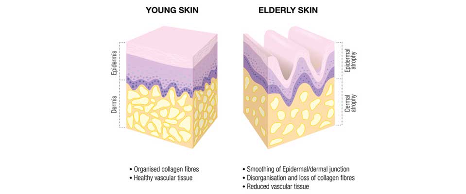 ABOUT COLLAGEN, YOUNG AND OLD SKIN