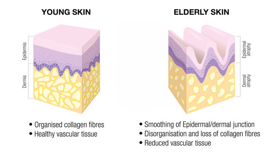 AGEING SKIN