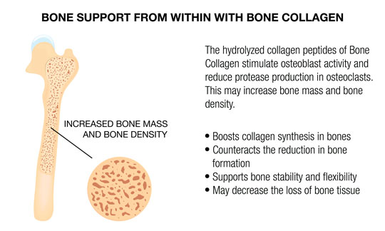 BONE SUPPORT